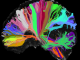 连接大脑的不同部分的彩色股线